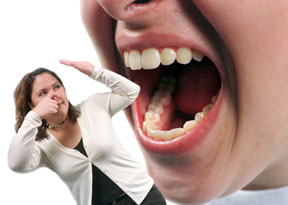 bai thuoc chua hoi mieng dau rang 01