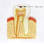 Tin tức và Kiến thức benh sau rang