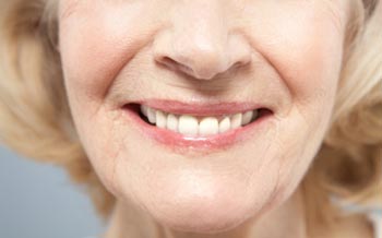 cham soc rang mieng nguoi cao tuoi 01