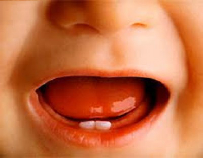 nguyen nhan rang sua tre bi sau