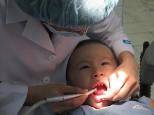 sau rang sua anh huong moc rang 01