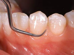 sua chua ngua viem loi 01