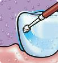 tac dung fluor doi voi rang 01