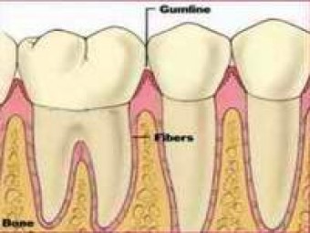 trieu chung benh nuou rang 01