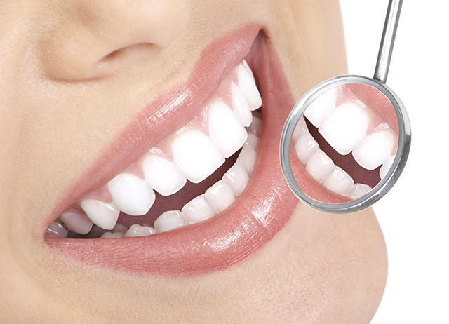 trong rang giai phap thay the rang uu viet nhat