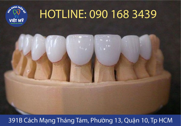 nha khoa tham my viet my rang su 02