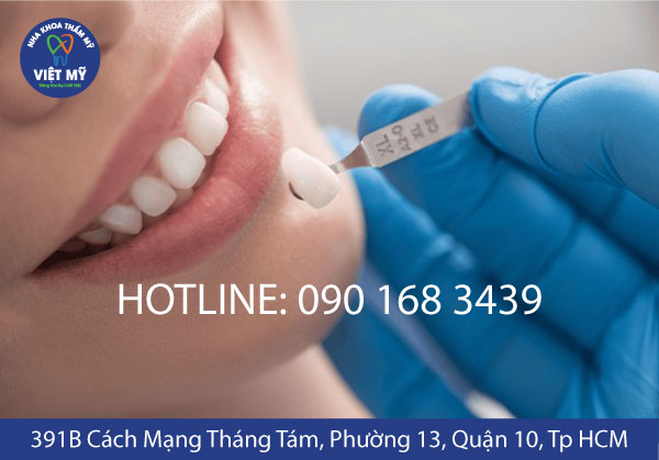 nha khoa tham my viet my rang su 04